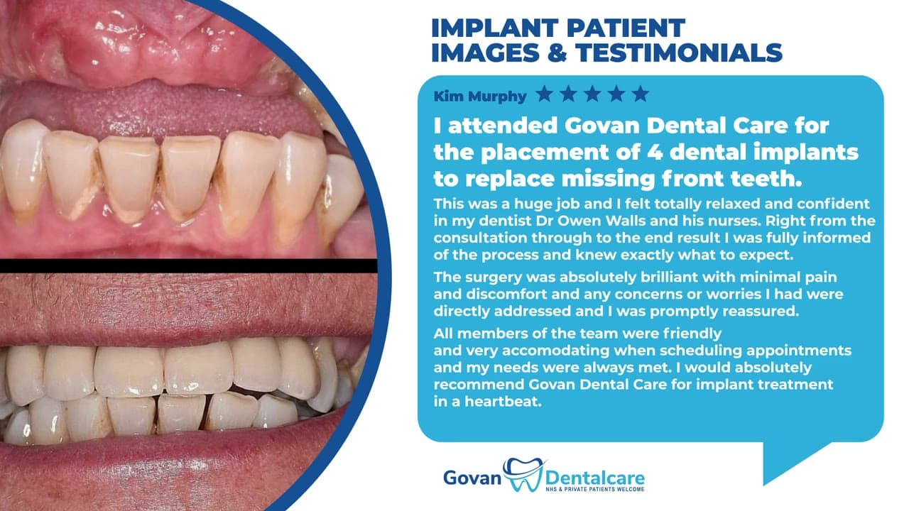 Dental implants clinic promotional animation